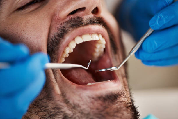 Best Emergency Denture Repair in Long Neck, DE